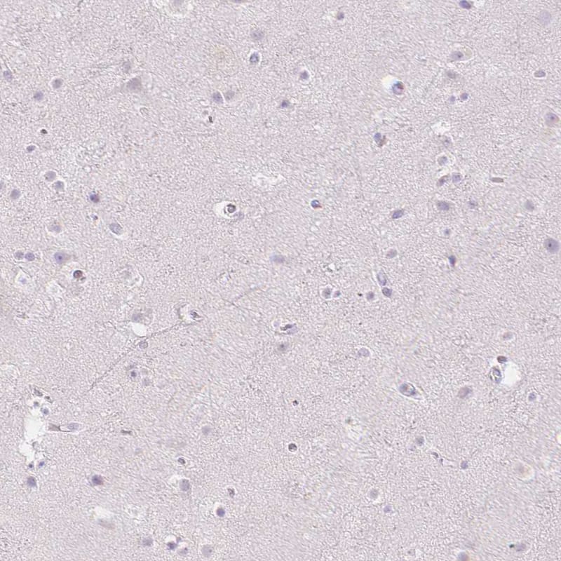 MMR/CD206/Mannose Receptor Antibody - BSA Free Immunohistochemistry-Paraffin: MMR/CD206/Mannose Receptor Antibody - BSA Free [NBP1-90020]