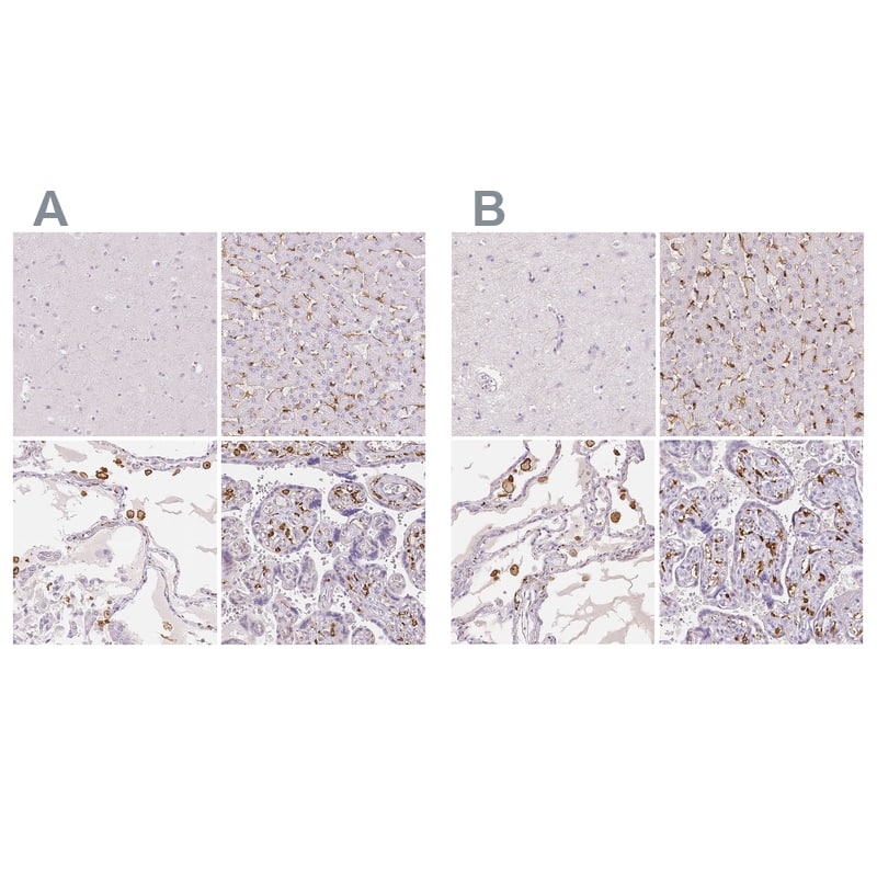 MMR/CD206/Mannose Receptor Antibody - BSA Free Immunohistochemistry-Paraffin: MMR/CD206/Mannose Receptor Antibody - BSA Free [NBP1-90020]