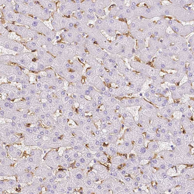 MMR/CD206/Mannose Receptor Antibody - BSA Free Immunohistochemistry-Paraffin: MMR/CD206/Mannose Receptor Antibody - BSA Free [NBP1-90020]