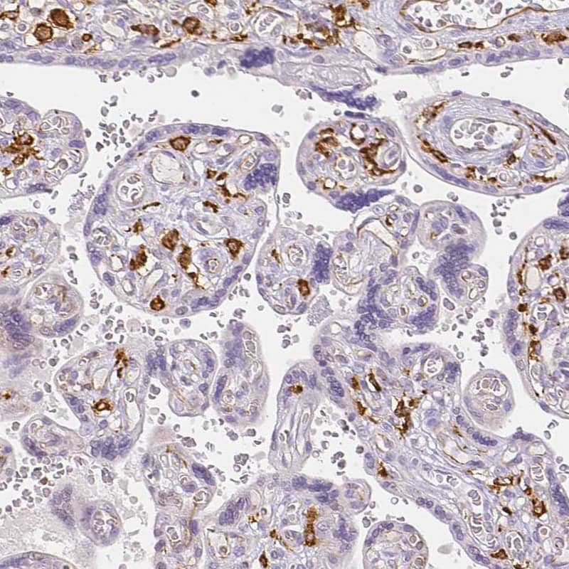 MMR/CD206/Mannose Receptor Antibody - BSA Free Immunohistochemistry-Paraffin: MMR/CD206/Mannose Receptor Antibody - BSA Free [NBP1-90020]