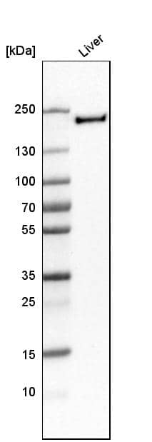 MMR/CD206/Mannose Receptor Antibody - BSA Free Western Blot: MMR/CD206/Mannose Receptor Antibody - BSA Free [NBP1-90020]