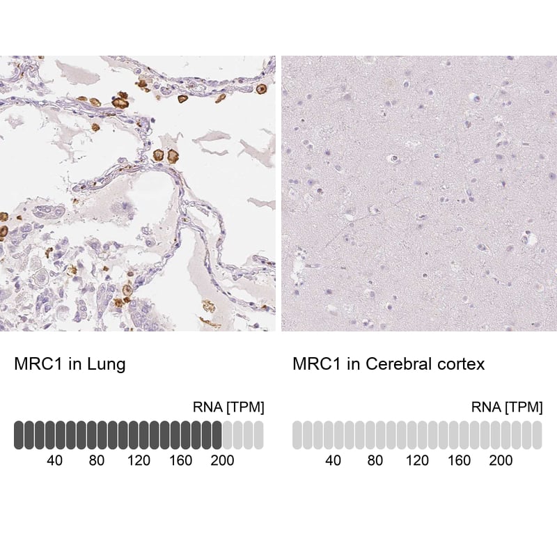 MMR/CD206/Mannose Receptor Antibody - BSA Free Immunohistochemistry-Paraffin: MMR/CD206/Mannose Receptor Antibody - BSA Free [NBP1-90020]