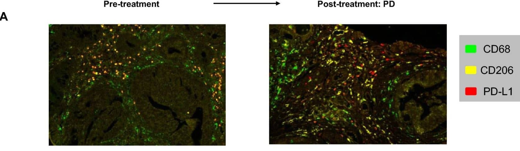 MMR/CD206/Mannose Receptor Antibody