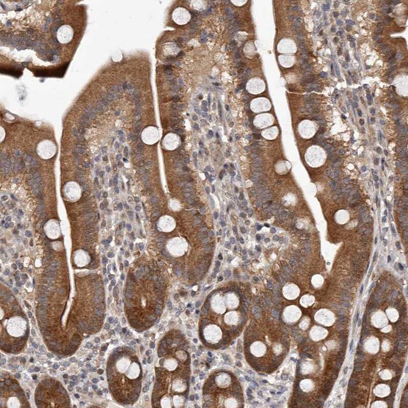Glutaredoxin 3/GLRX3 Antibody - BSA Free Immunohistochemistry-Paraffin: Glutaredoxin 3/GLRX3 Antibody - BSA Free [NBP1-90021]
