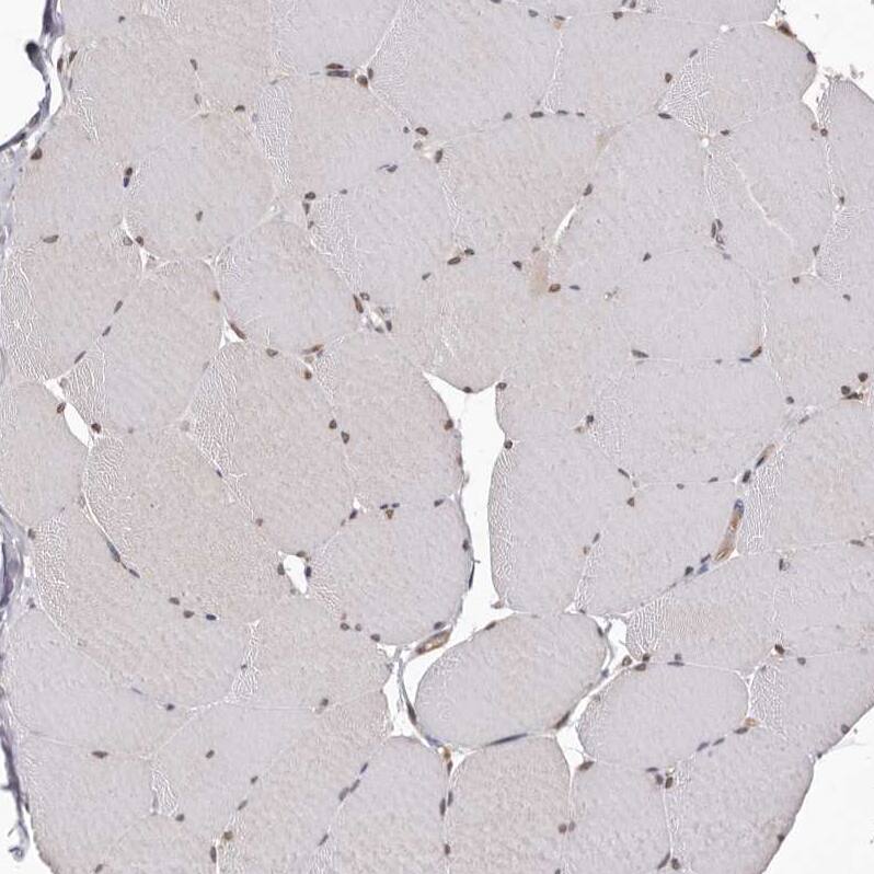 Glutaredoxin 3/GLRX3 Antibody - BSA Free Immunohistochemistry-Paraffin: Glutaredoxin 3/GLRX3 Antibody - BSA Free [NBP1-90021]