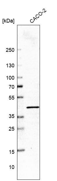 Glutaredoxin 3/GLRX3 Antibody - BSA Free Western Blot: Glutaredoxin 3/GLRX3 Antibody - BSA Free [NBP1-90021]