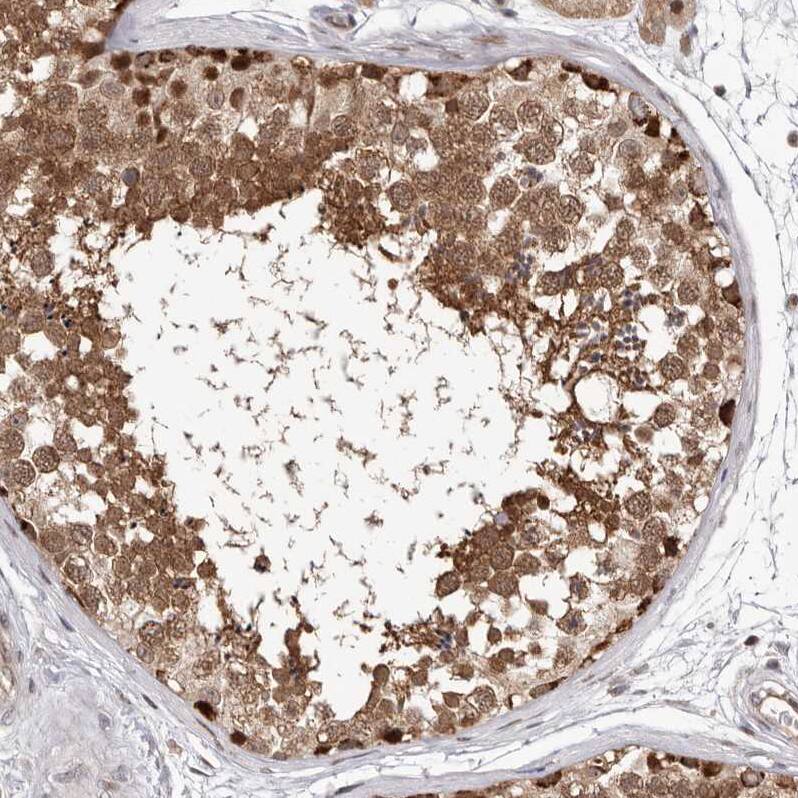 Glutaredoxin 3/GLRX3 Antibody - BSA Free Immunohistochemistry-Paraffin: Glutaredoxin 3/GLRX3 Antibody - BSA Free [NBP1-90021]