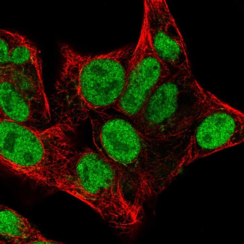 Chk2 Antibody - BSA Free Immunocytochemistry/ Immunofluorescence: Chk2 Antibody [NBP1-90024]