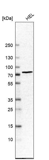 Chk2 Antibody - BSA Free Western Blot: Chk2 Antibody - BSA Free [NBP1-90024]