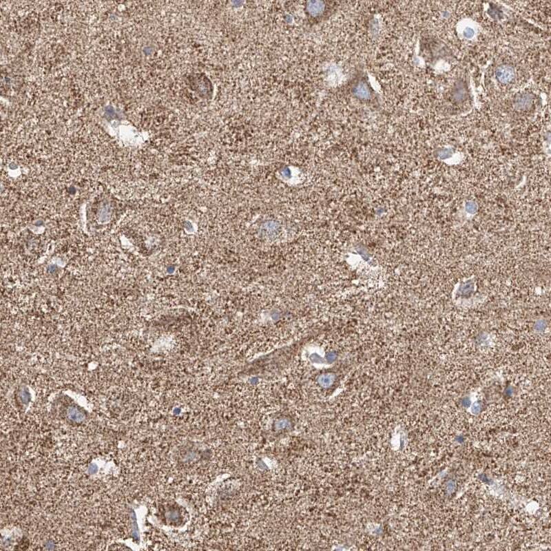 VGCNL1 Antibody - BSA Free Immunohistochemistry-Paraffin: VGCNL1 Antibody - BSA Free [NBP1-90026]