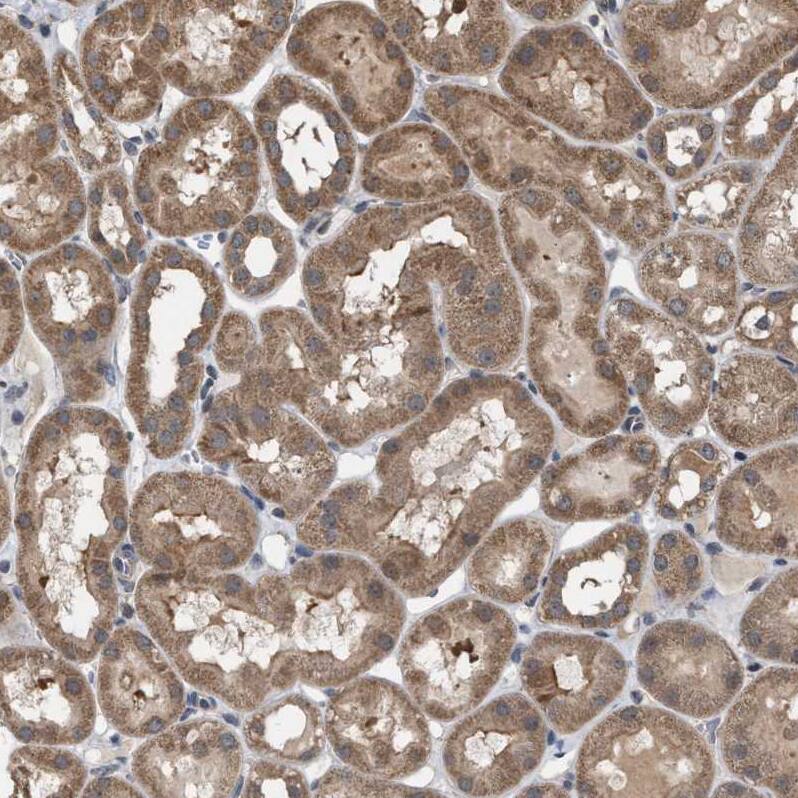 MAK10 Antibody - BSA Free Immunohistochemistry-Paraffin: MAK10 Antibody - BSA Free [NBP1-90032]