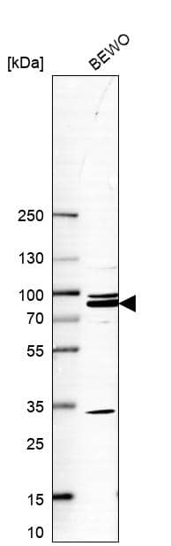 MAK10 Antibody - BSA Free Western Blot: MAK10 Antibody - BSA Free [NBP1-90032]