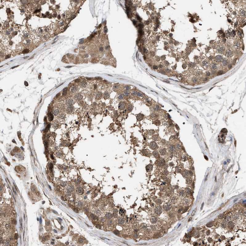 MAK10 Antibody - BSA Free Immunohistochemistry-Paraffin: MAK10 Antibody - BSA Free [NBP1-90032]
