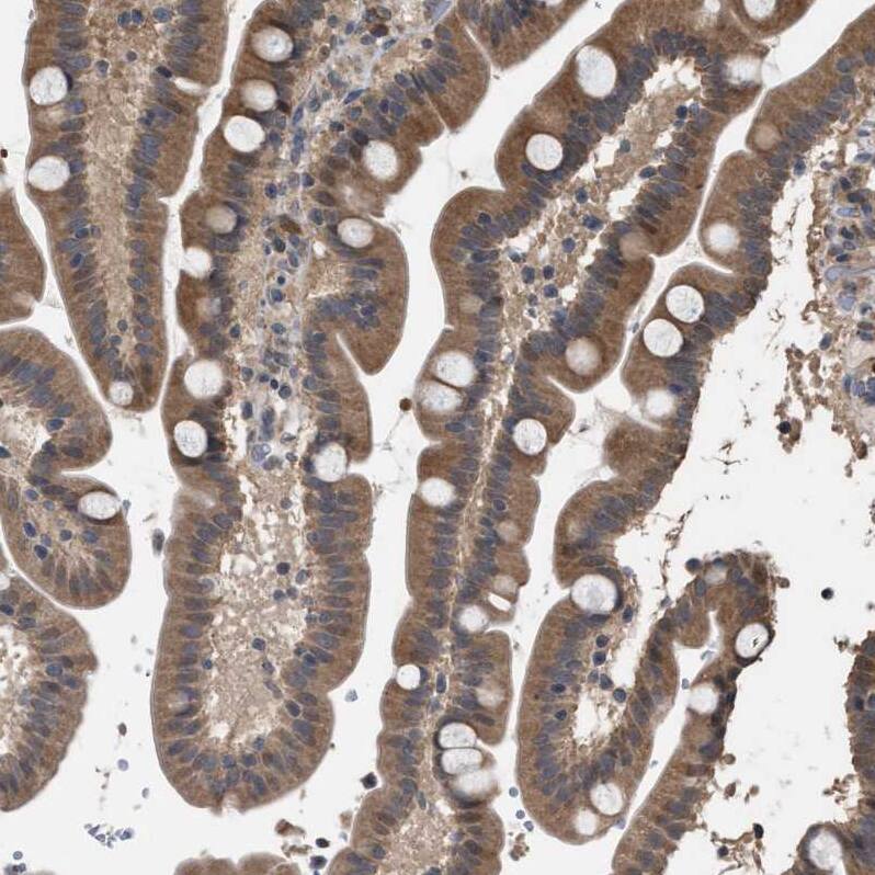 MAK10 Antibody - BSA Free Immunohistochemistry-Paraffin: MAK10 Antibody - BSA Free [NBP1-90032]