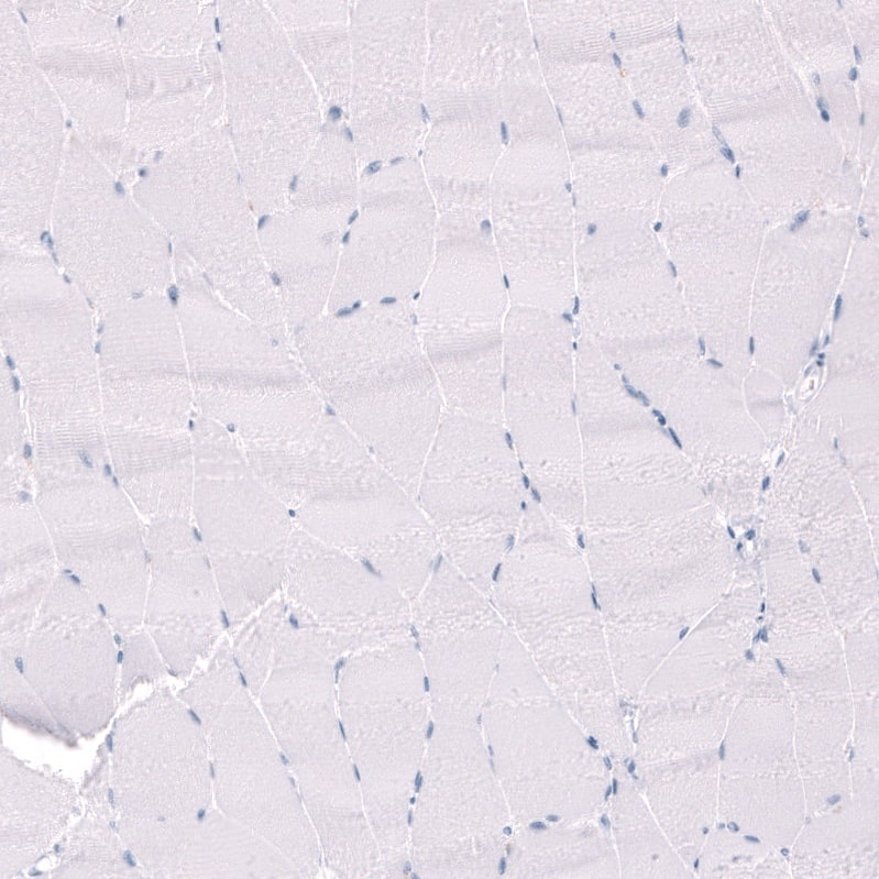 EYS/RP25 Antibody - BSA Free Immunohistochemistry-Paraffin: EYS/RP25 Antibody - BSA Free [NBP1-90038]