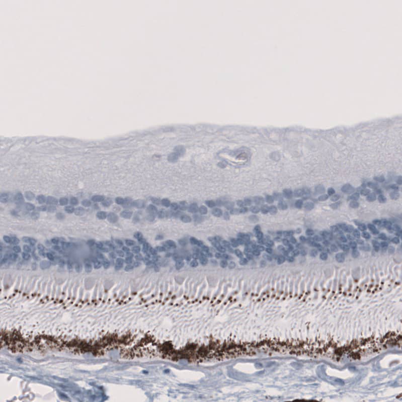 EYS/RP25 Antibody - BSA Free Immunohistochemistry-Paraffin: EYS/RP25 Antibody - BSA Free [NBP1-90038]