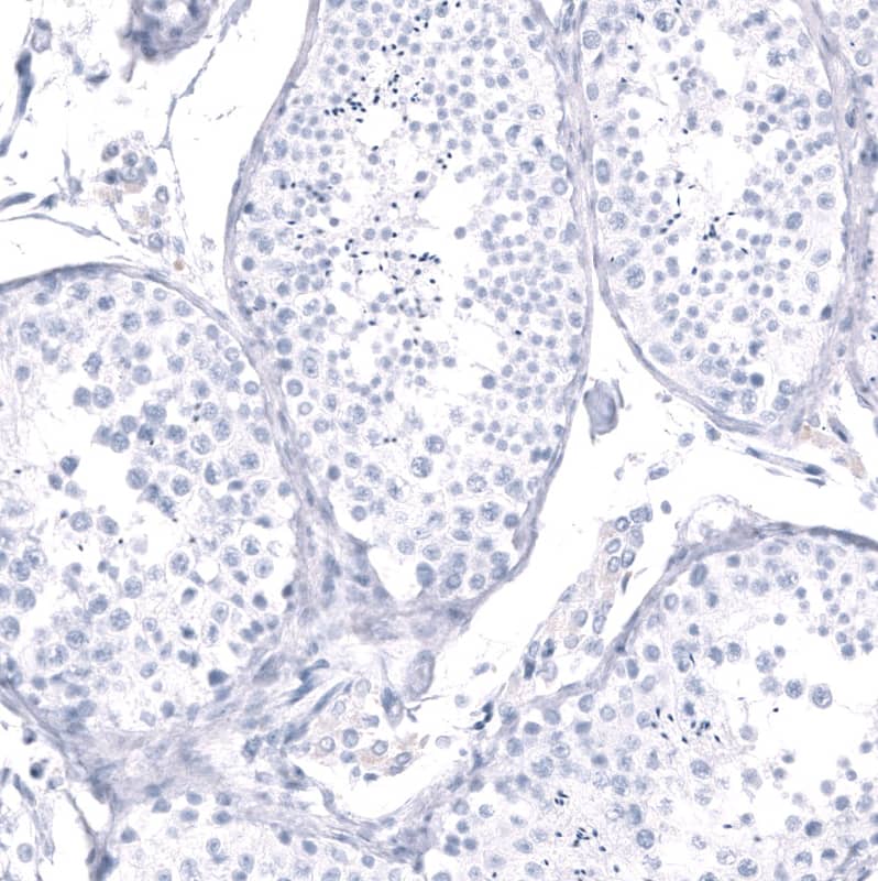 EYS/RP25 Antibody - BSA Free Immunohistochemistry-Paraffin: EYS/RP25 Antibody - BSA Free [NBP1-90038]