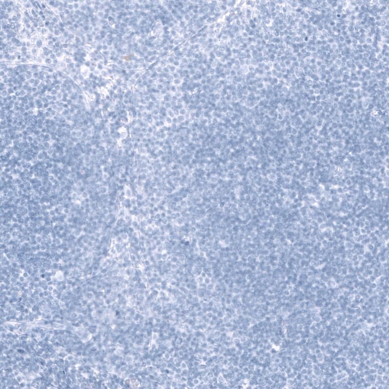 EYS/RP25 Antibody - BSA Free Immunohistochemistry-Paraffin: EYS/RP25 Antibody - BSA Free [NBP1-90038]