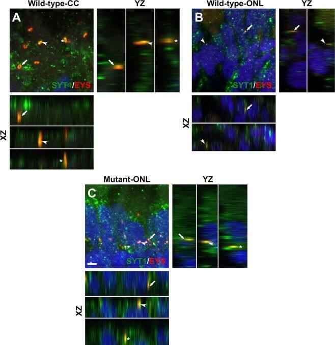 EYS/RP25 Antibody