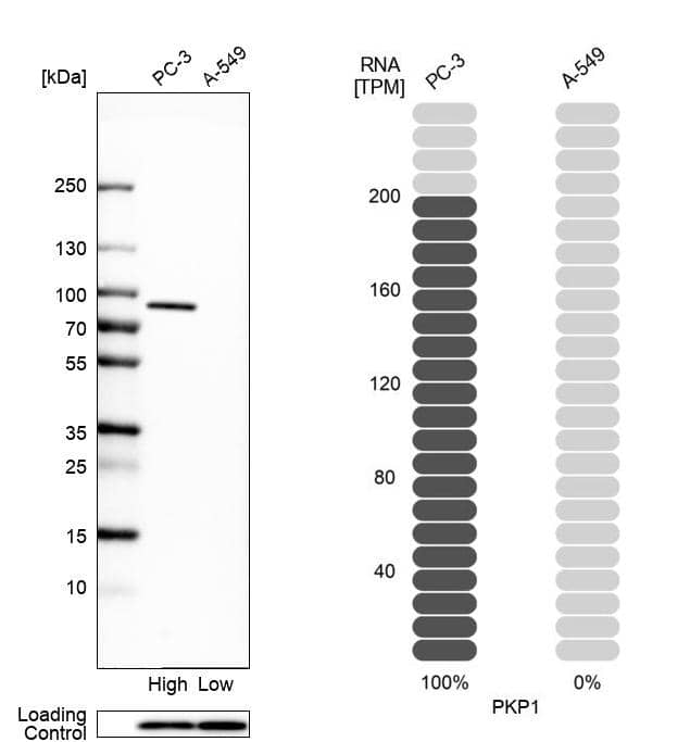 Plakophilin 1 Antibody - BSA Free Western Blot: Plakophilin 1 Antibody - BSA Free [NBP1-90041]