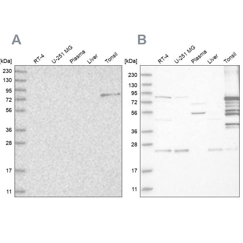 Plakophilin 1 Antibody - BSA Free Western Blot: Plakophilin 1 Antibody - BSA Free [NBP1-90041]