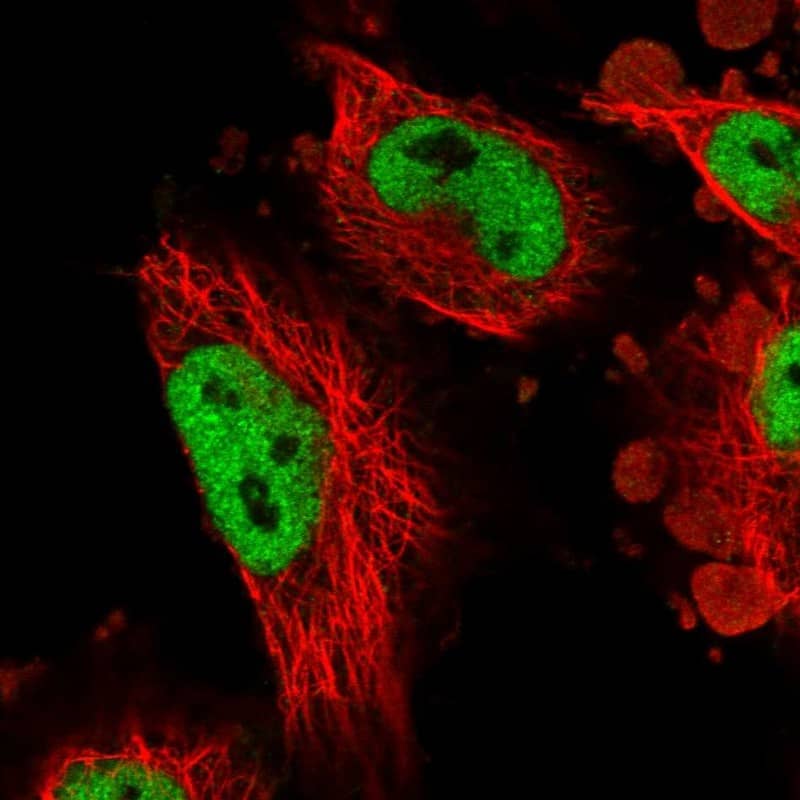 ATN1 Antibody - BSA Free Immunocytochemistry/ Immunofluorescence: ATN1 Antibody - BSA Free [NBP1-90044]