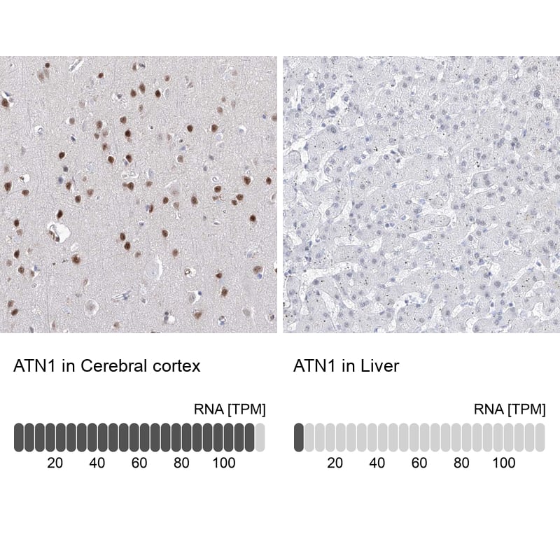 ATN1 Antibody - BSA Free Immunohistochemistry: ATN1 Antibody - BSA Free [NBP1-90044]
