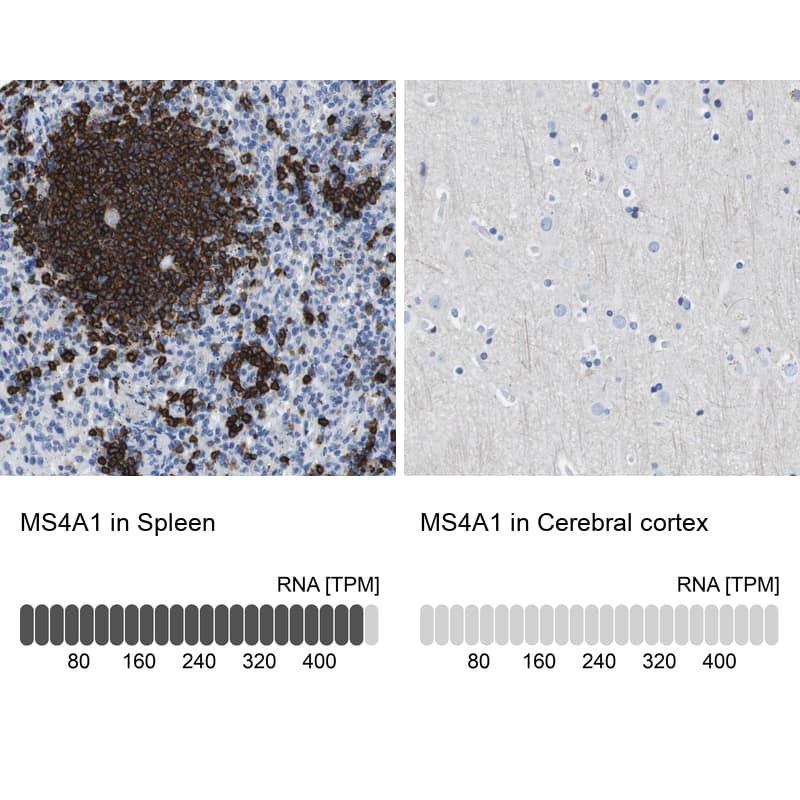 CD20 Antibody - BSA Free Immunohistochemistry: CD20 Antibody - BSA Free [NBP1-90051]