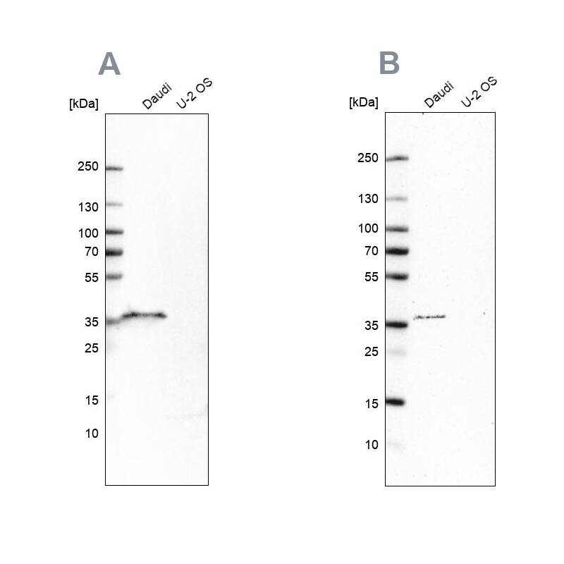 CD20 Antibody - BSA Free Western Blot: CD20 Antibody - BSA Free [NBP1-90051]