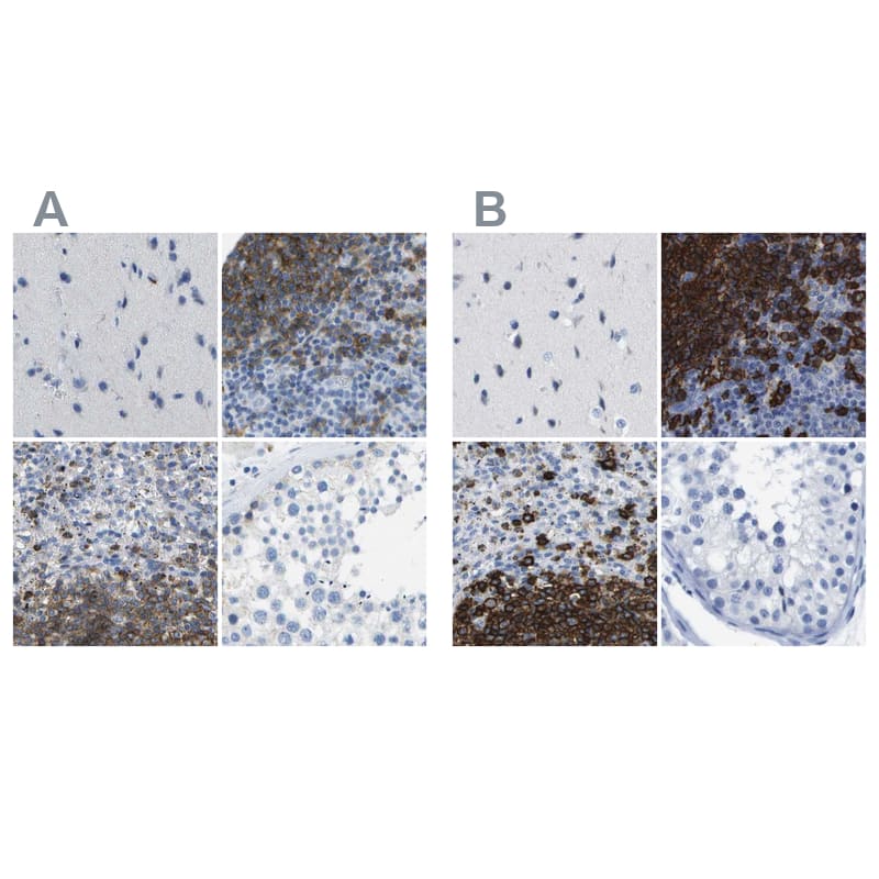 CD20 Antibody - BSA Free Immunohistochemistry: CD20 Antibody - BSA Free [NBP1-90052]