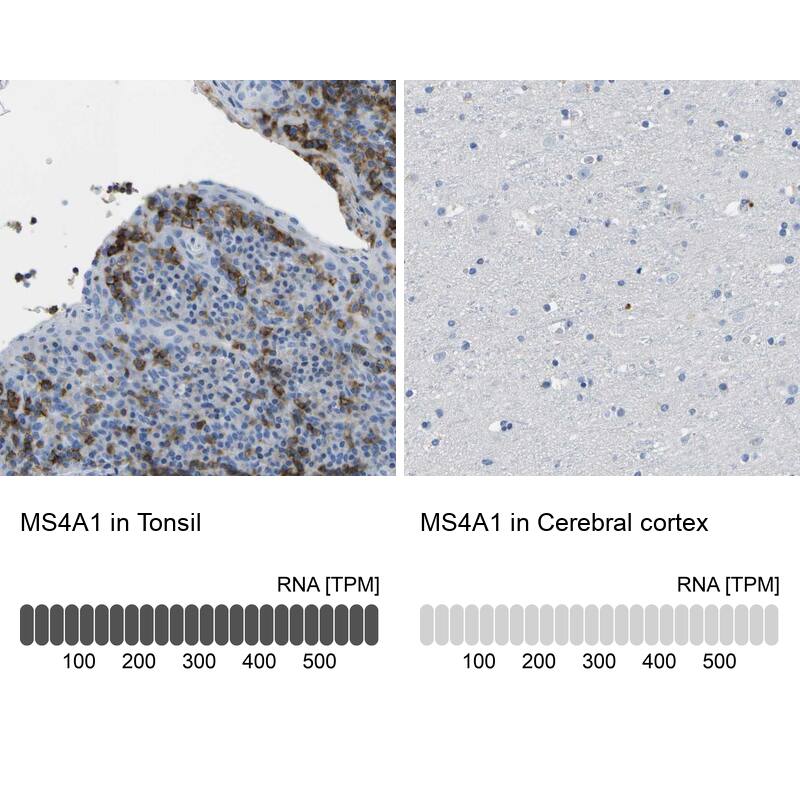 CD20 Antibody - BSA Free Immunohistochemistry: CD20 Antibody - BSA Free [NBP1-90052]