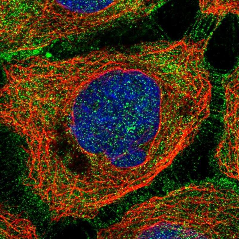 Axotrophin Antibody - BSA Free Immunocytochemistry/ Immunofluorescence: Axotrophin Antibody [NBP1-90057]