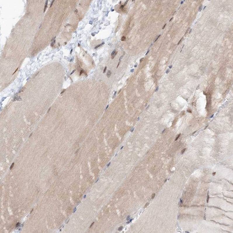 ZA20D3 Antibody - BSA Free Immunohistochemistry: ZA20D3 Antibody - BSA Free [NBP1-90060]