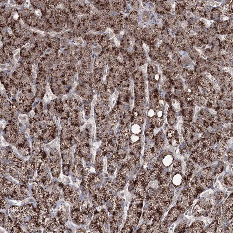 ZA20D3 Antibody - BSA Free Immunohistochemistry: ZA20D3 Antibody - BSA Free [NBP1-90060]