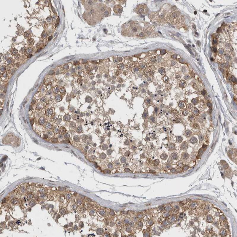 Ataxin-2 Antibody - BSA Free Immunohistochemistry: Ataxin-2 Antibody - BSA Free [NBP1-90062]