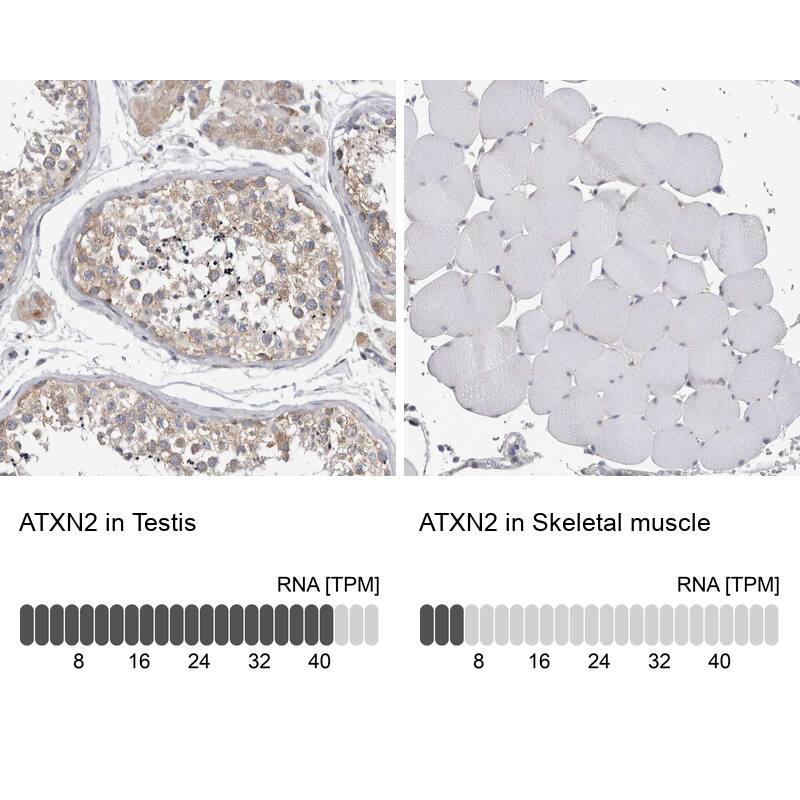 Ataxin-2 Antibody - BSA Free Immunohistochemistry: Ataxin-2 Antibody - BSA Free [NBP1-90063]