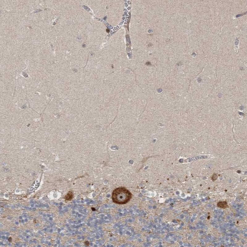 Ataxin-2 Antibody - BSA Free Immunohistochemistry: Ataxin-2 Antibody - BSA Free [NBP1-90064]