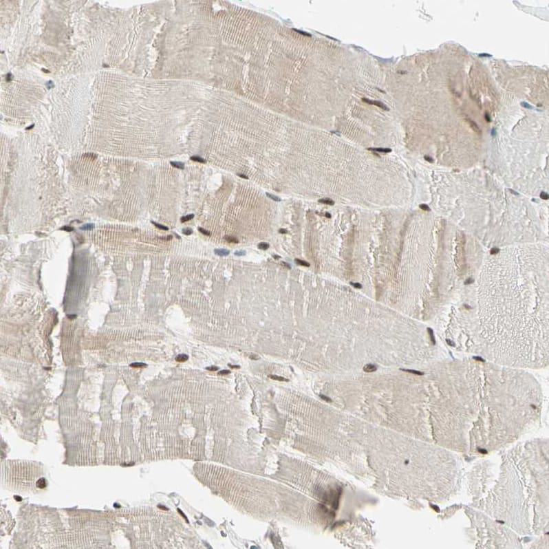 Ataxin 1 Antibody - BSA Free Immunohistochemistry: Ataxin 1 Antibody - BSA Free [NBP1-90065]