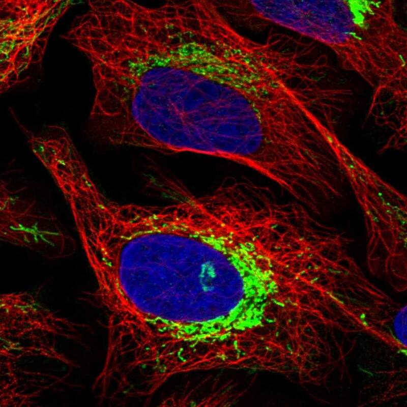 ATPase Inhibitory Factor 1 Antibody - BSA Free Immunocytochemistry/ Immunofluorescence: ATPase Inhibitory Factor 1 Antibody [NBP1-90069]