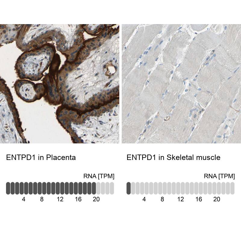 CD39/ENTPD1 Antibody - BSA Free Immunohistochemistry: CD39/ENTPD1 Antibody - BSA Free [NBP1-90071]