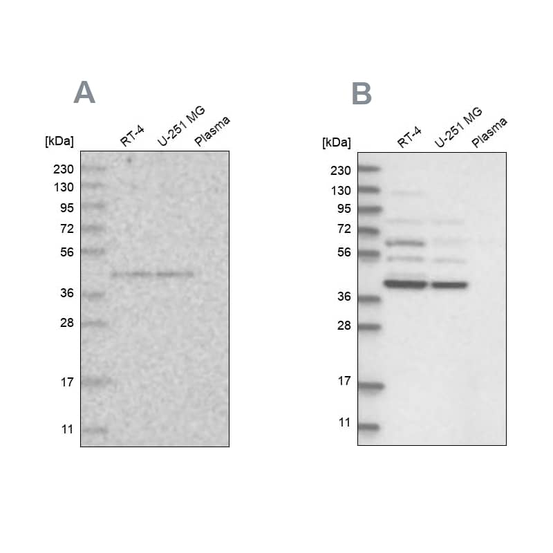 XAB1 Antibody - BSA Free Western Blot: XAB1 Antibody - BSA Free [NBP1-90072]