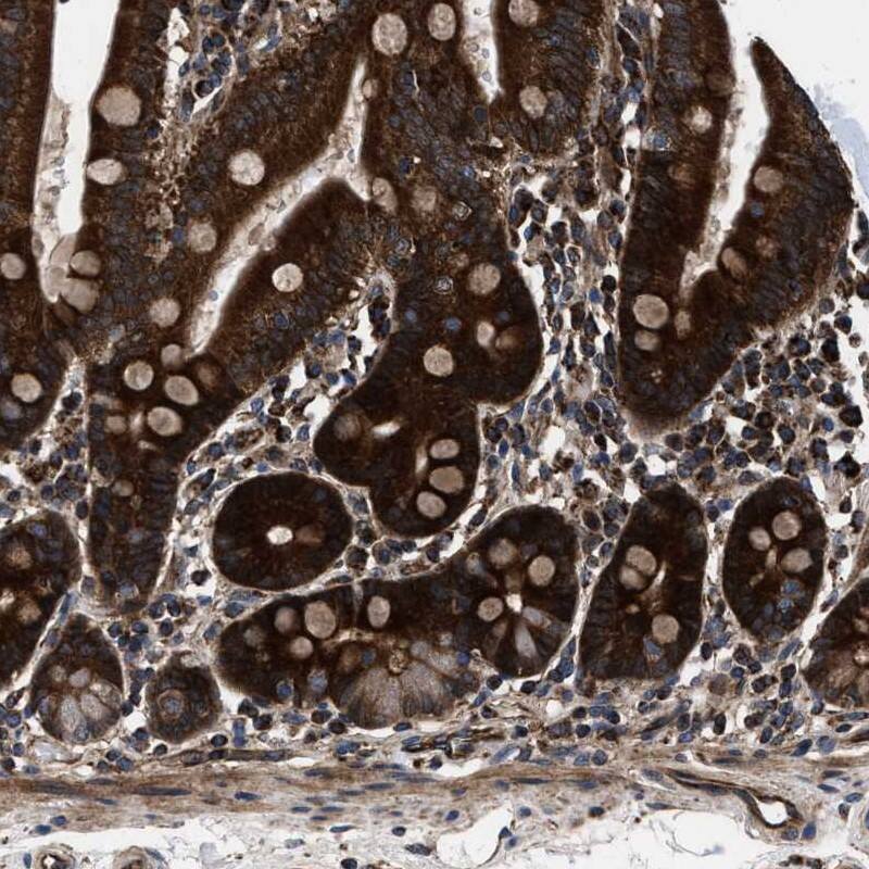 ATAD4 Antibody - BSA Free Immunohistochemistry: ATAD4 Antibody - BSA Free [NBP1-90075]