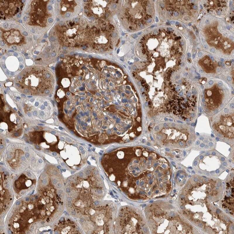 Serpin C1/Antithrombin-III Antibody - BSA Free Immunohistochemistry-Paraffin: Serpin C1/Antithrombin-III Antibody [NBP1-90077]