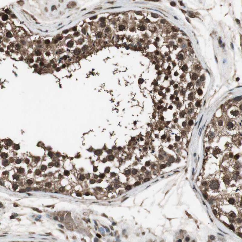 ASPP1 Antibody - BSA Free Immunohistochemistry: ASPP1 Antibody - BSA Free [NBP1-90078]