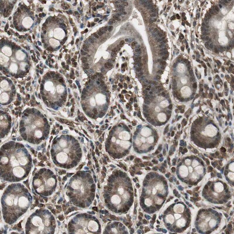 ASPP1 Antibody - BSA Free Immunohistochemistry: ASPP1 Antibody - BSA Free [NBP1-90078]