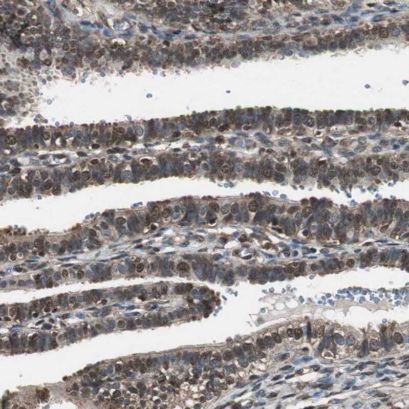 ASPP1 Antibody - BSA Free Immunohistochemistry: ASPP1 Antibody - BSA Free [NBP1-90078]