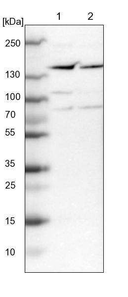 ASPP1 Antibody - BSA Free Western Blot: ASPP1 Antibody - BSA Free [NBP1-90078]