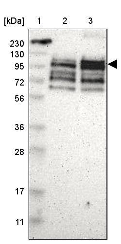 ASPP1 Antibody - BSA Free Western Blot: ASPP1 Antibody - BSA Free [NBP1-90078]
