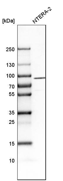 Neuroligin 3/NLGN3 Antibody - BSA Free Western Blot: Neuroligin 3/NLGN3 Antibody - BSA Free [NBP1-90080]