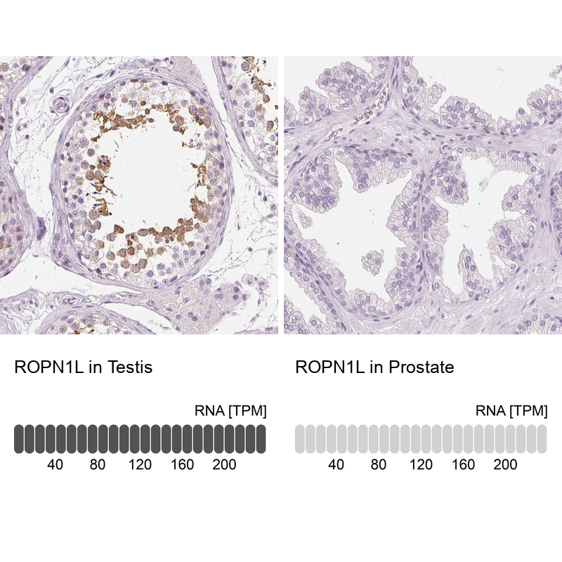 Ropporin 1-like Antibody - BSA Free Immunohistochemistry: Ropporin 1-like Antibody - BSA Free [NBP1-90081]